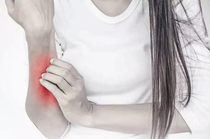 Nietolerancja histaminy czy to zwykła alergia